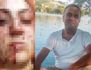 Eski eşi tarafından 7 yerinden bıçaklanmıştı! Artık de cezaevine girecek