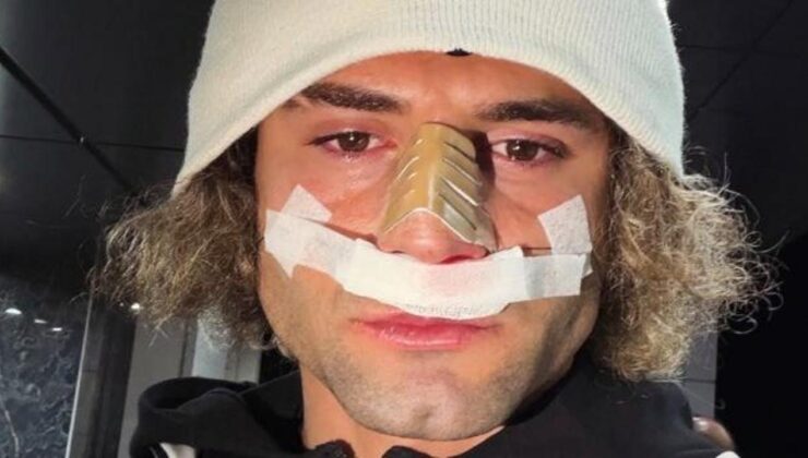 2. Lig’in gol hükümdarının burnu kırıldı! Maçı bu formda tamamladı